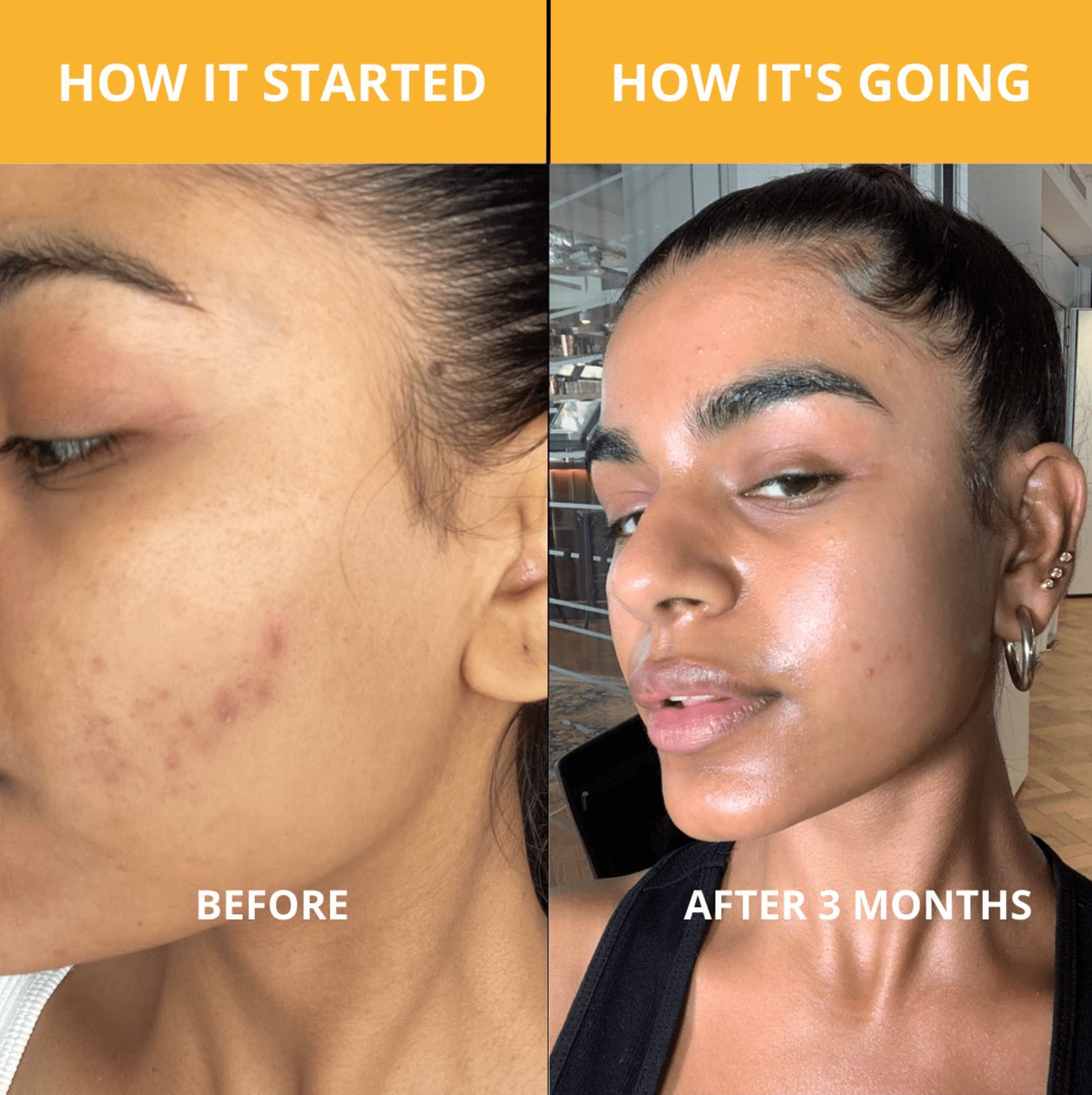 TUMERI Turmeric Kojic Acid Soap - Face and Body