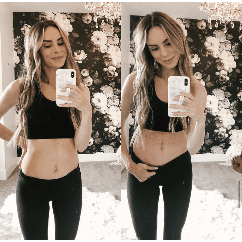 The Spoiled Mama Tummy Butter Post Pregnancy Stretch Mark Cream