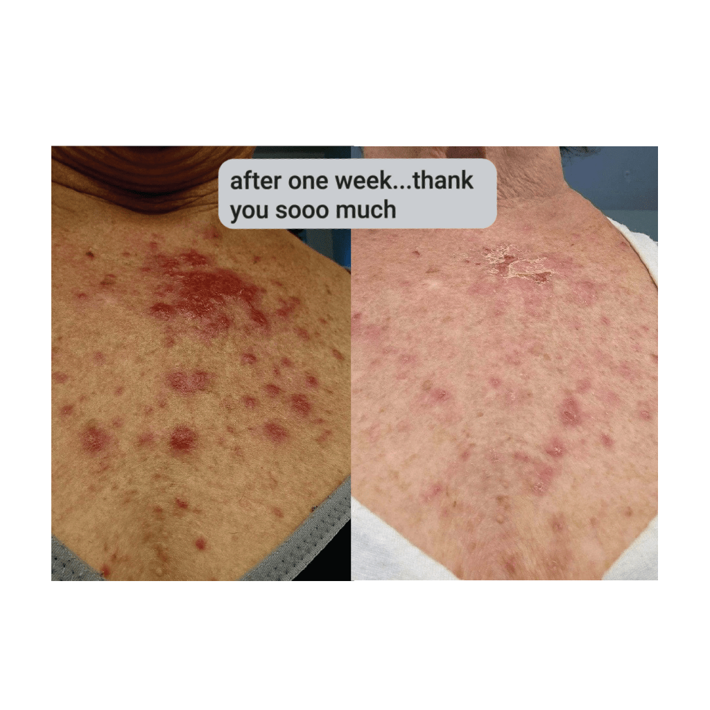 MYSKINBUDDY Bee Bright Night Mode