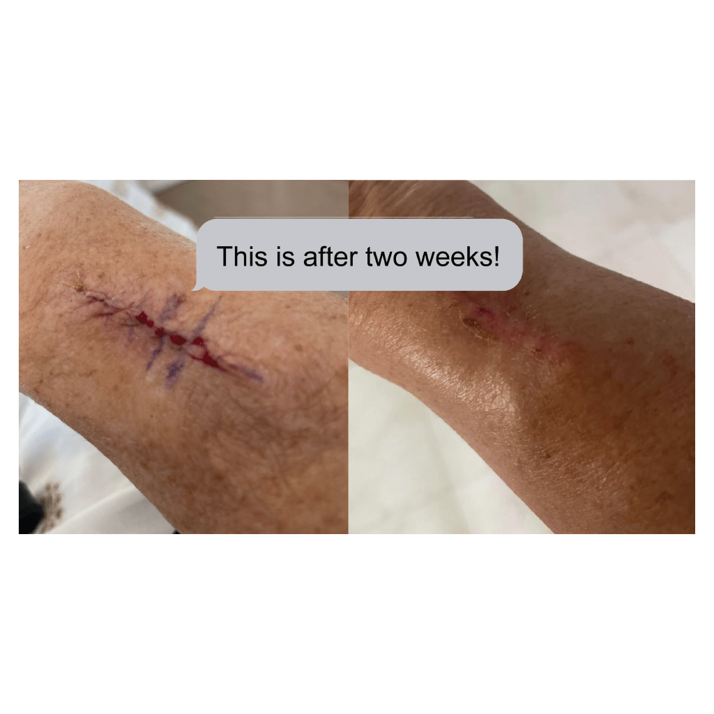 MYSKINBUDDY Bee Bright Night Mode