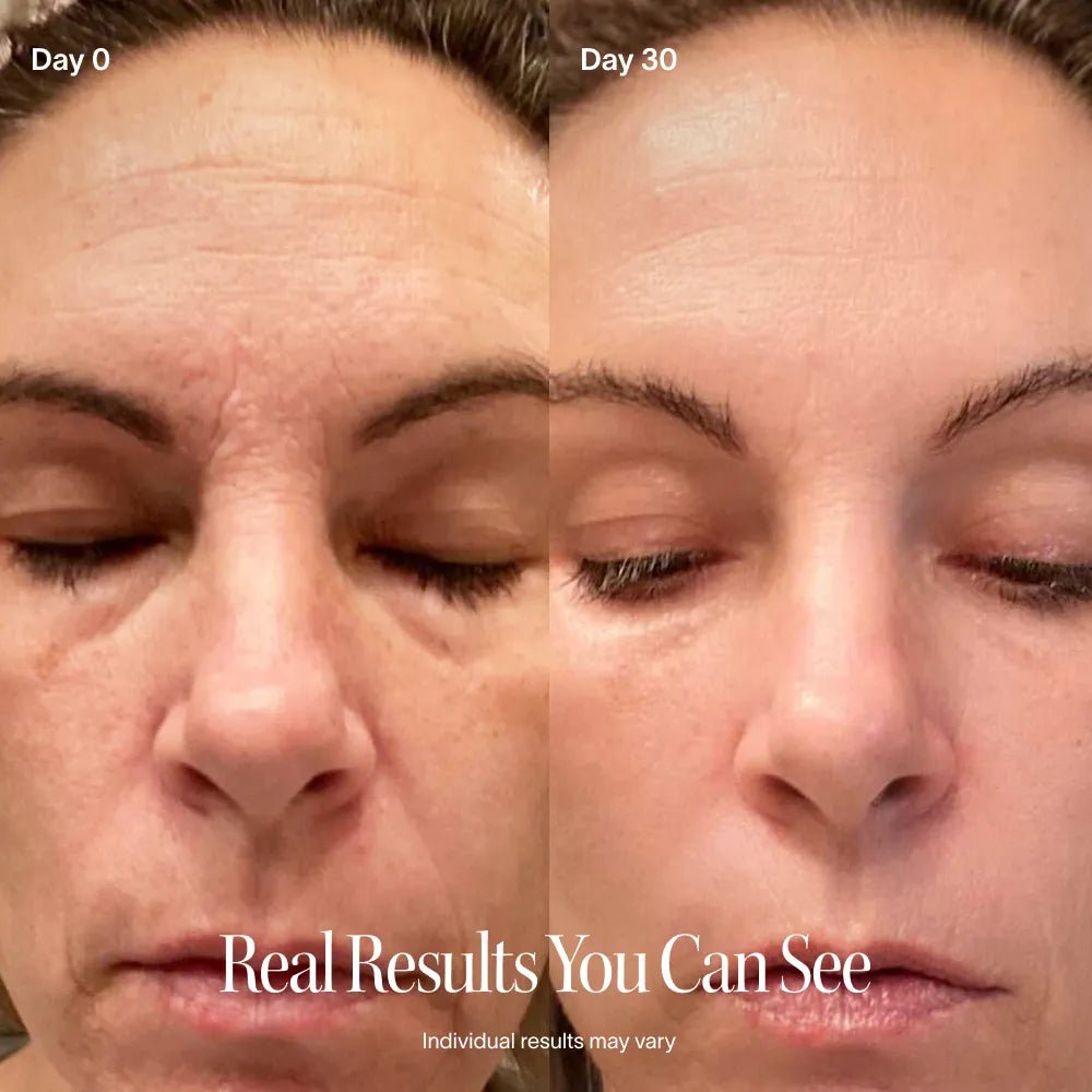 Solawave 4 - in - 1 Red Light Therapy Wand & Activating Serum Kit