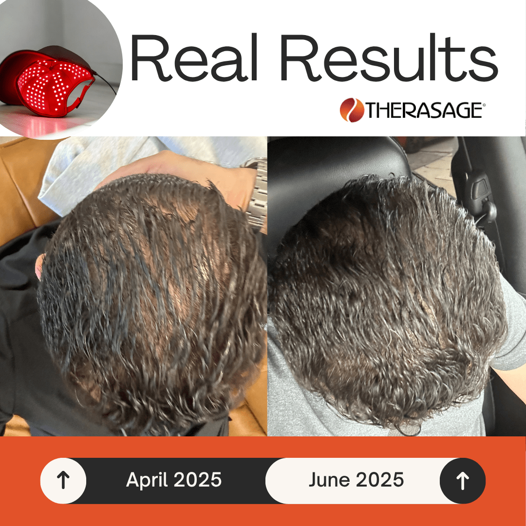 Therasage TheraCap Red Light Therapy Hair & Scalp Device