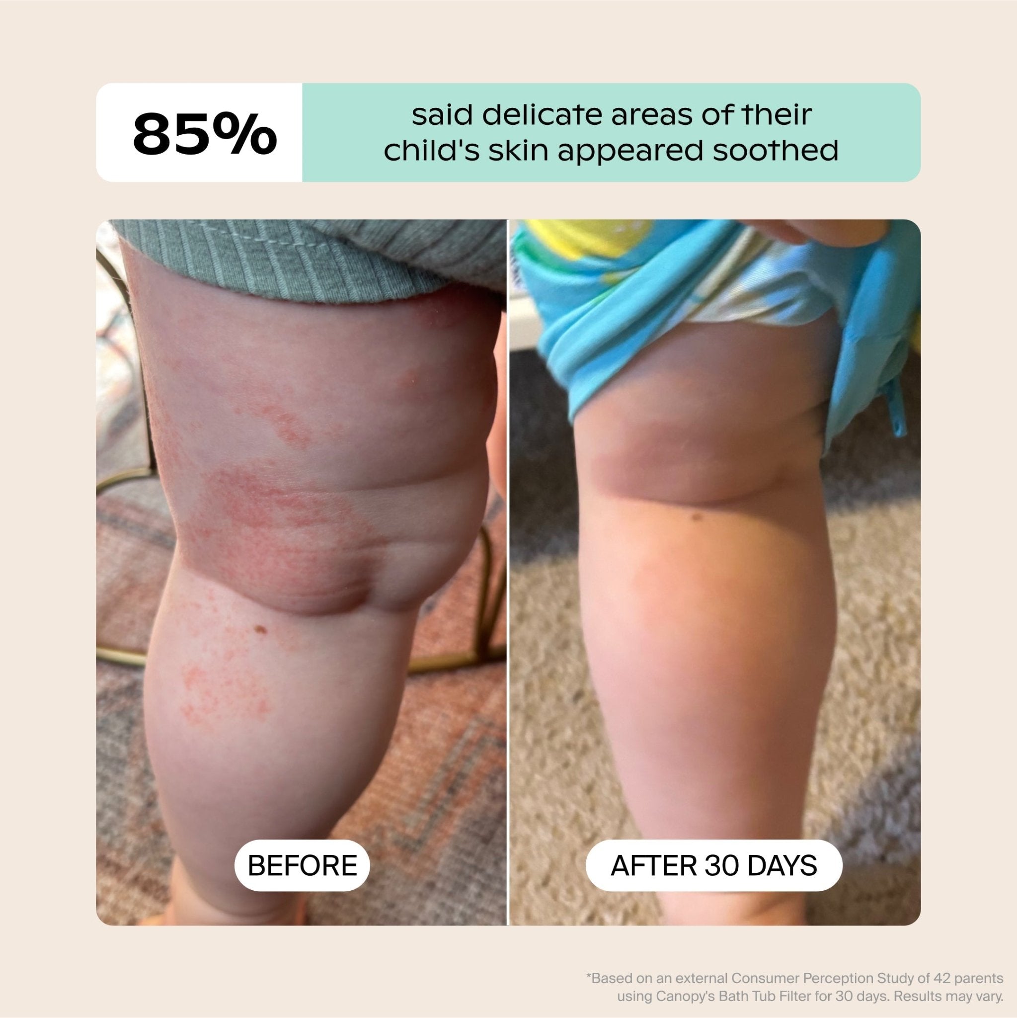 Canopy Baby Bath Tub Filter