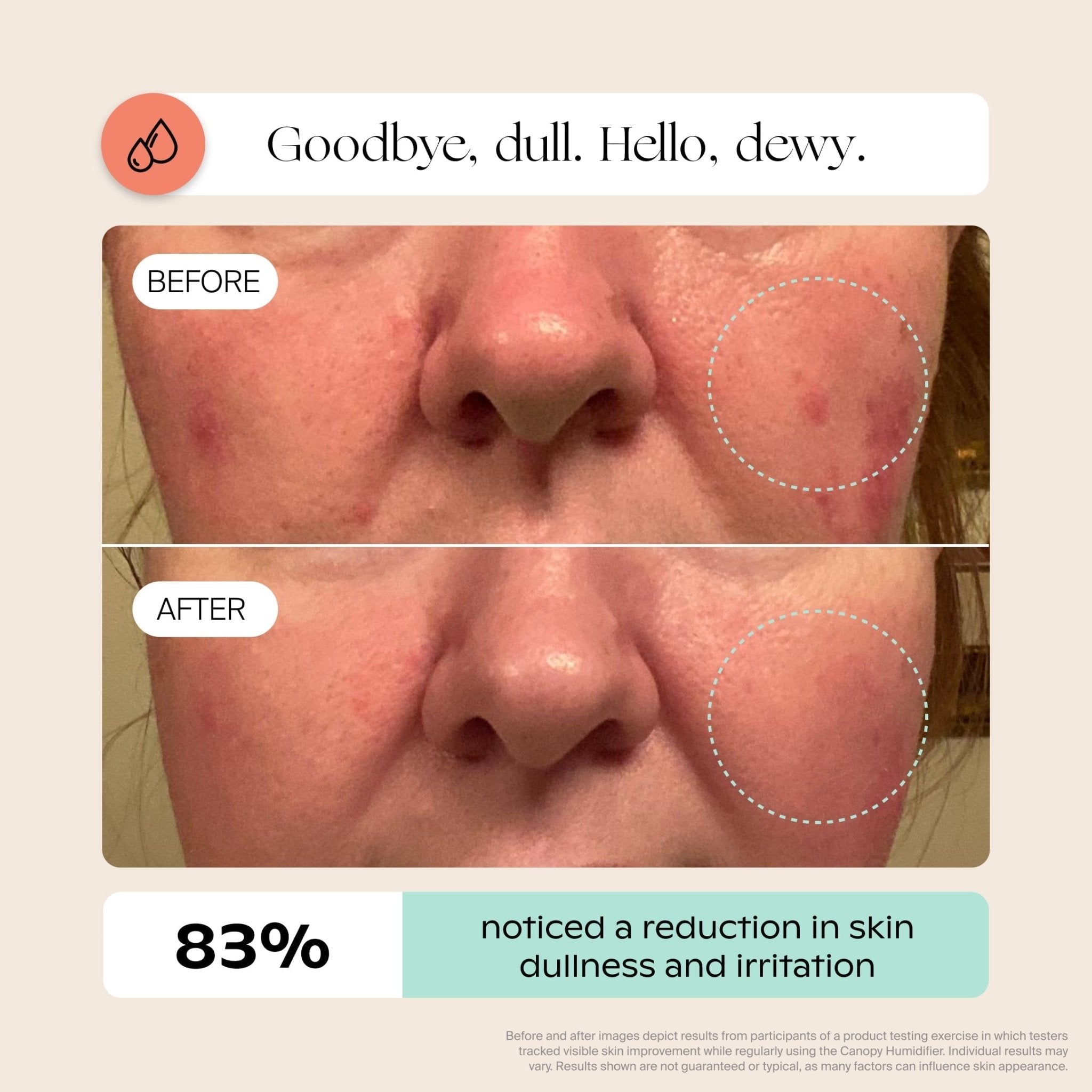 Canopy Bedside Humidifier 2.0