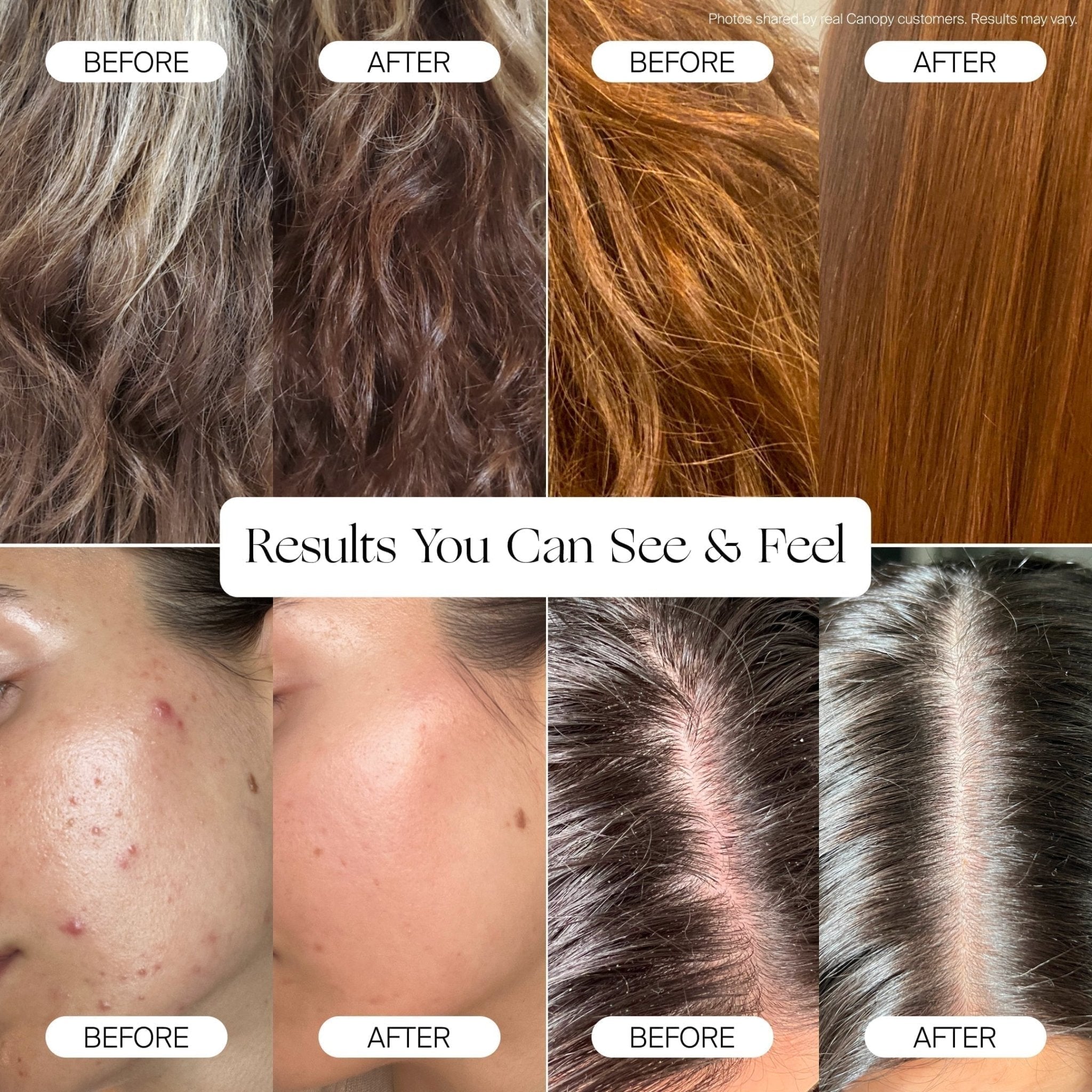 Canopy Filtered Showerhead