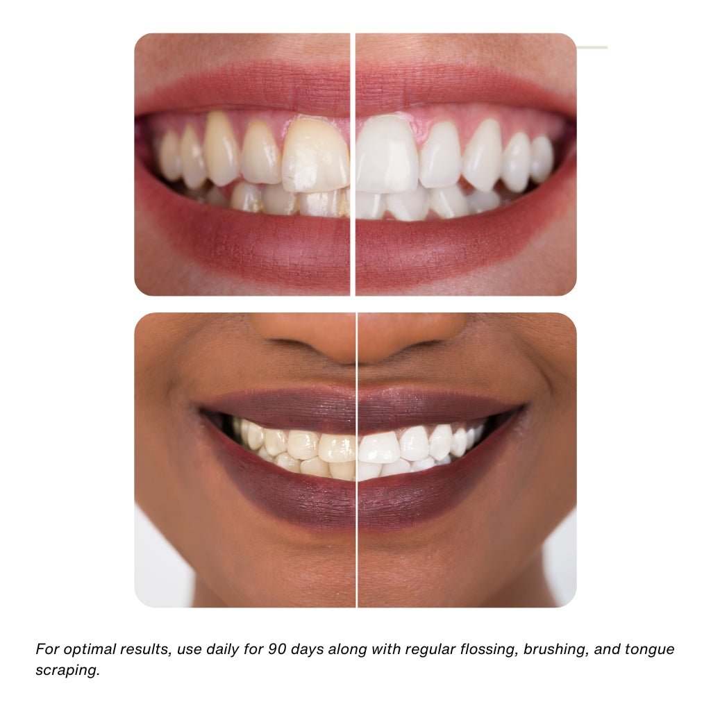 KÖPPEN Daily Oil Mouthwash | Healthy Teeth & Gums