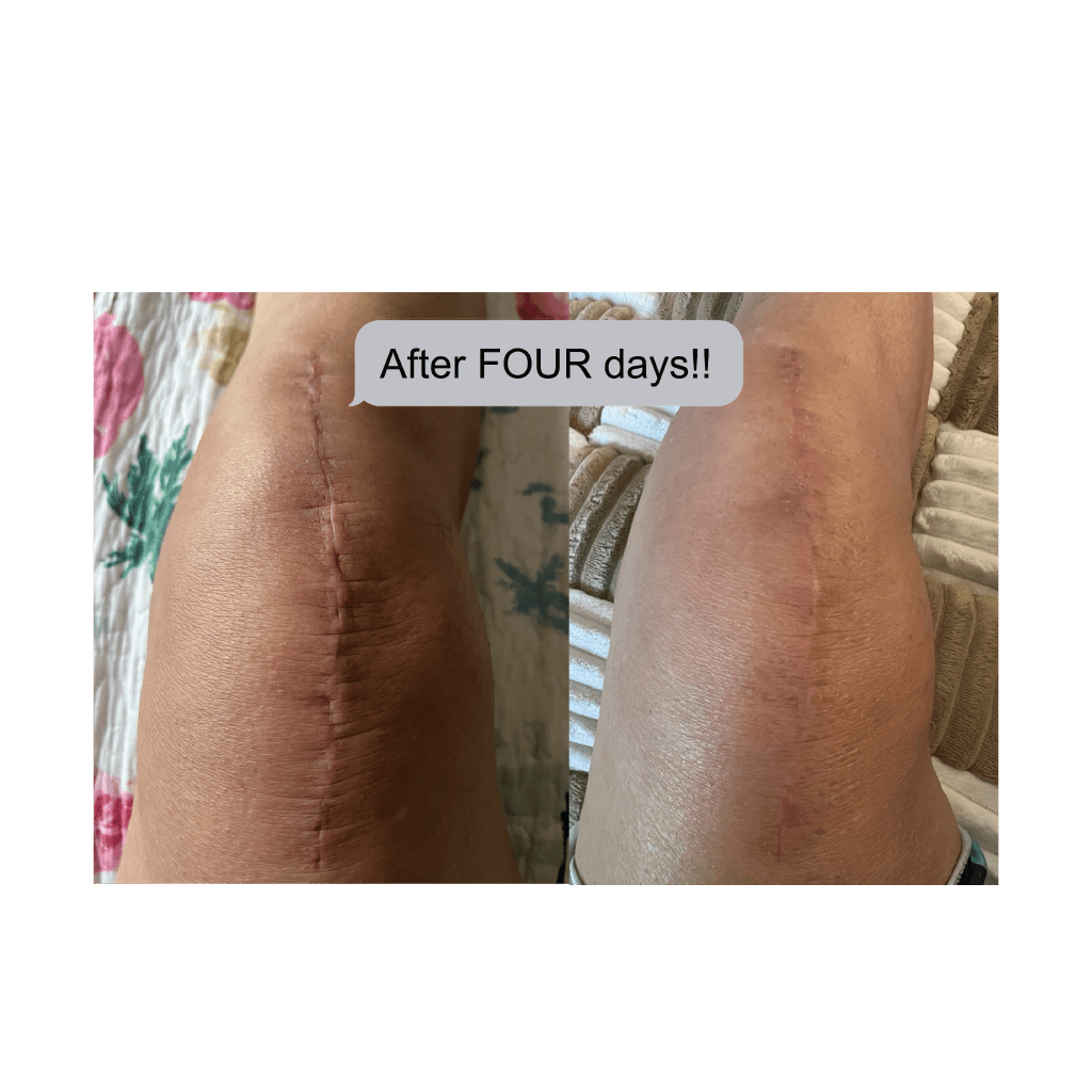 MYSKINBUDDY Bee Bright Night Mode