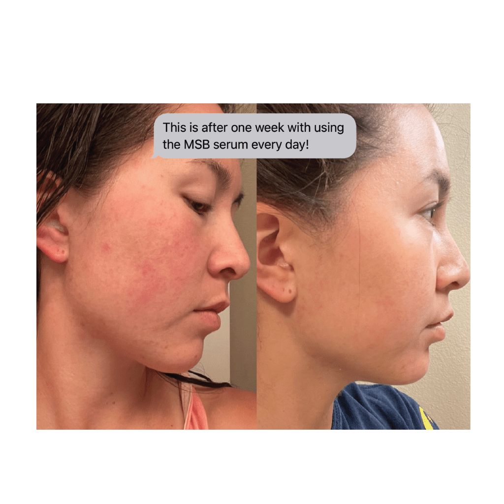 MYSKINBUDDY Bee Bright Night Mode