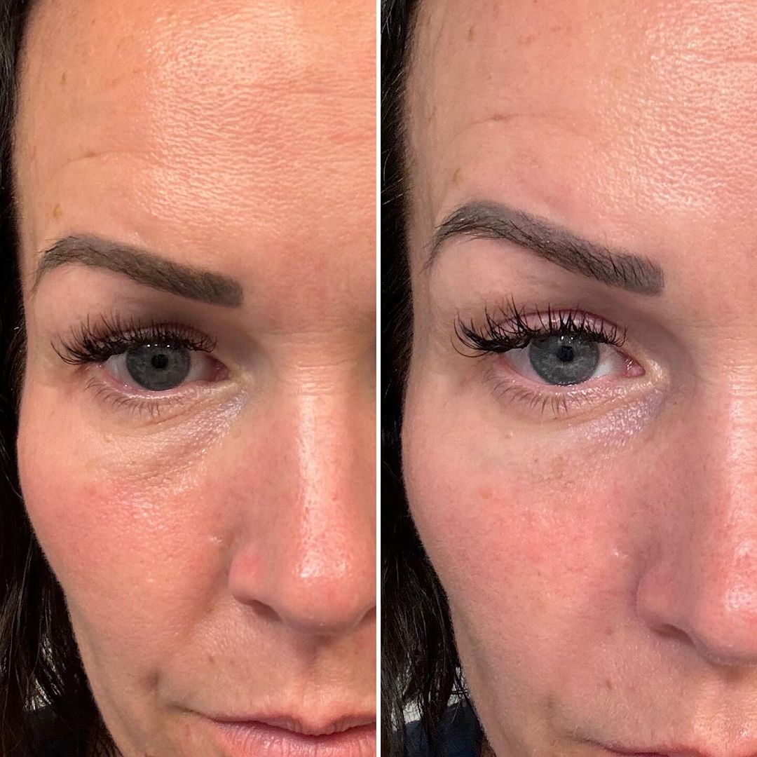 MYSKINBUDDY BOOST PINK