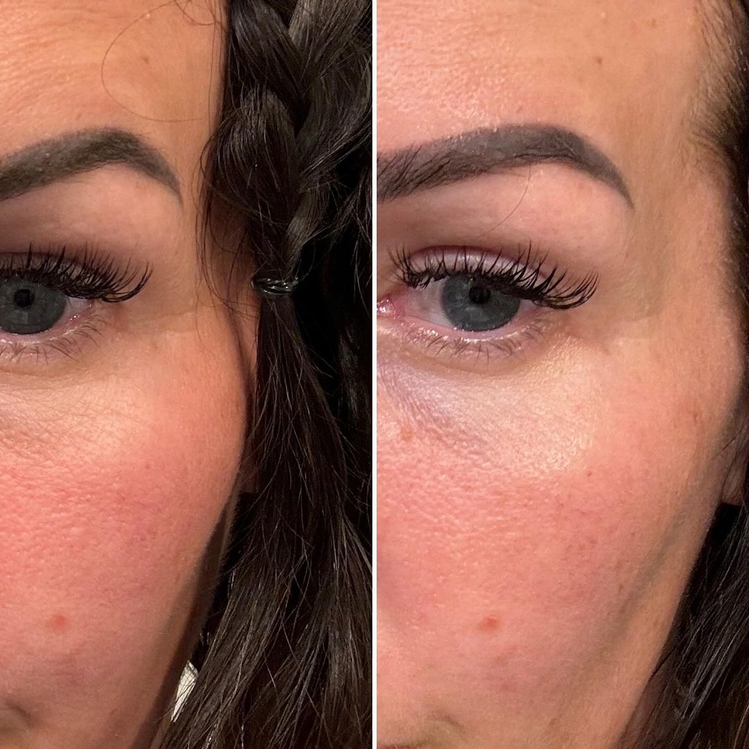 MYSKINBUDDY BOOST Pretty - in - Pink