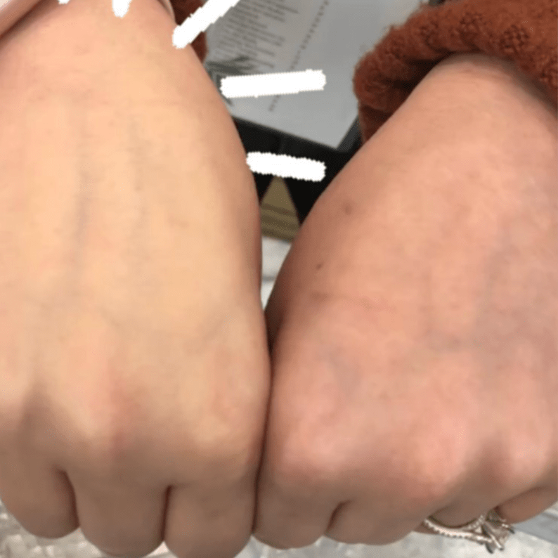 MYSKINBUDDY BOOST WHITE