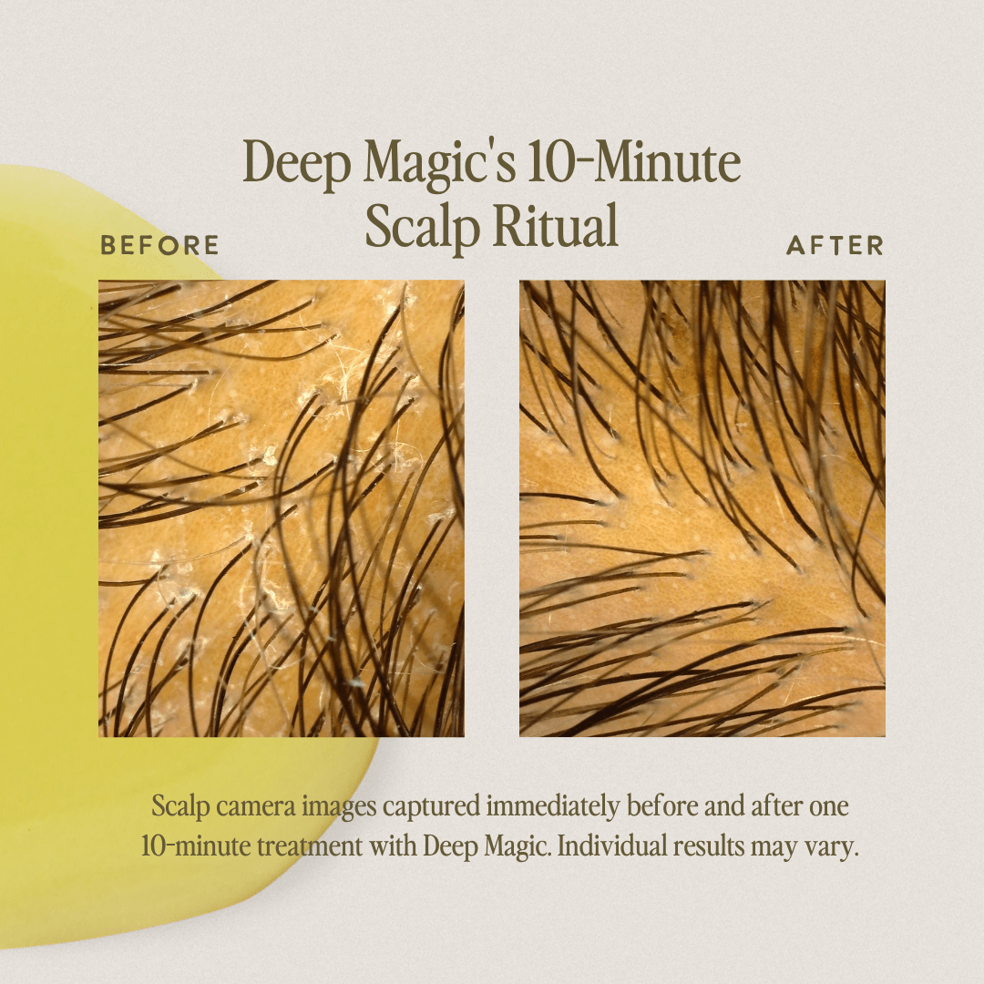 UNDER LUNA™ Deep Magic Hair + Scalp Serum